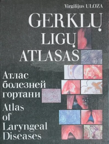 Gerklų ligų atlasas