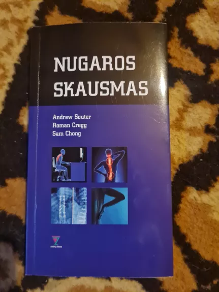 Nugaros skausmas