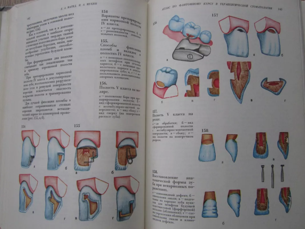 Atlas po fantomnomu kursu v terapevticeskoi stomatologii - J. Magidovas, knyga