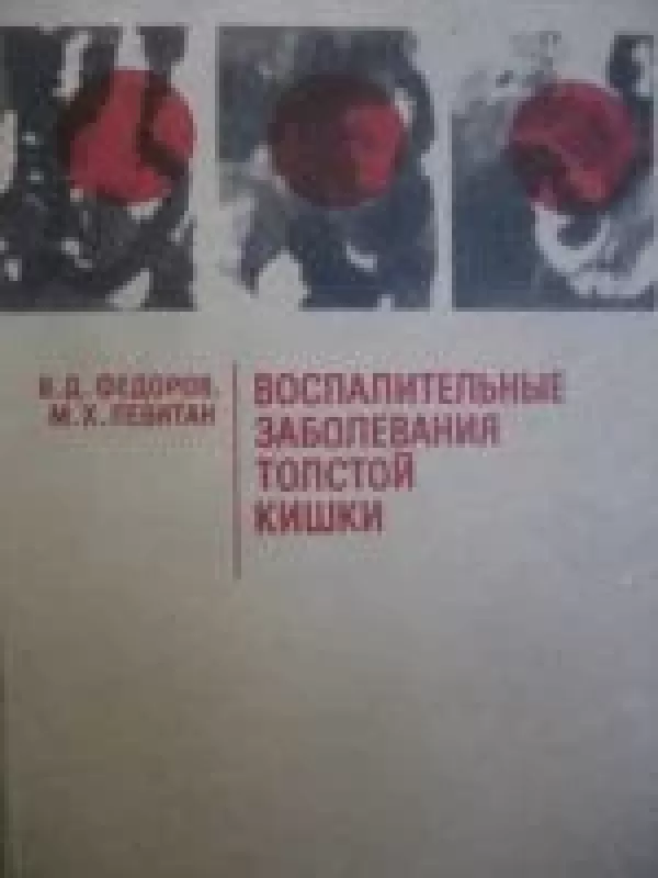 Воспалительные заболевания толстой кишки - В.Д. Федоров, М.Х.  Левитан, knyga