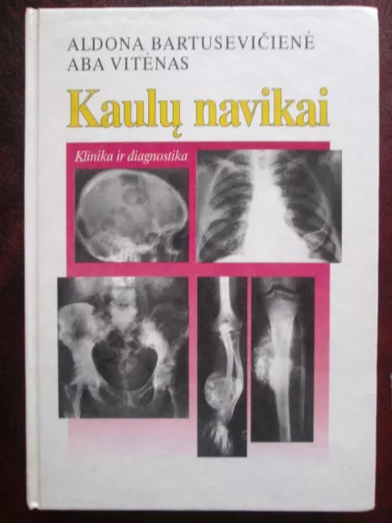 Kaulų navikai - Vytėnas A. Bartusevičienė A., knyga