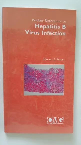Hepatitis B Virus Infection - Autorių Kolektyvas, knyga