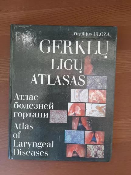 Gerklų ligų atlasas - Virgilijus Uloza, knyga