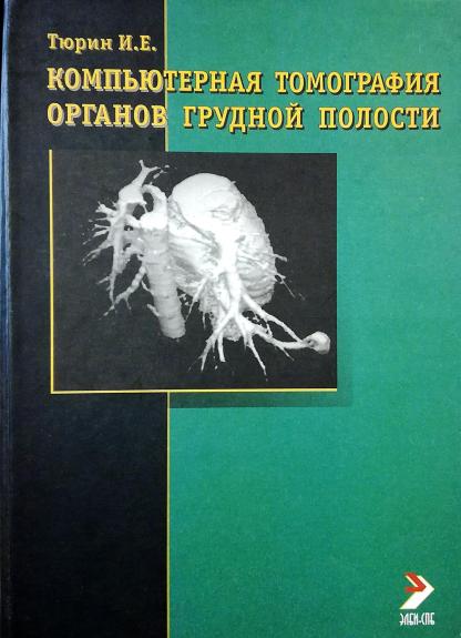Компьютерная томография органов грудной полости
