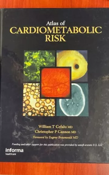 Atlas of cardiometabolic risc - William T Cefalu, knyga 1