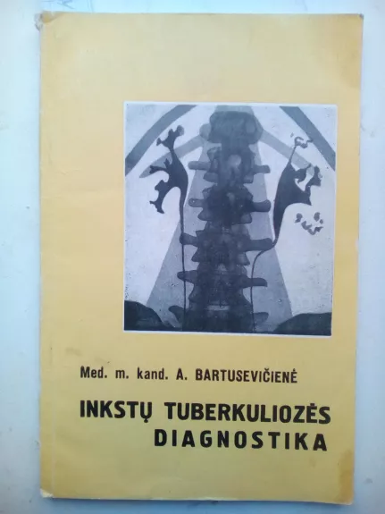 Inkstų tuberkuliozės diagnostika - A. Bartusevičienė, knyga