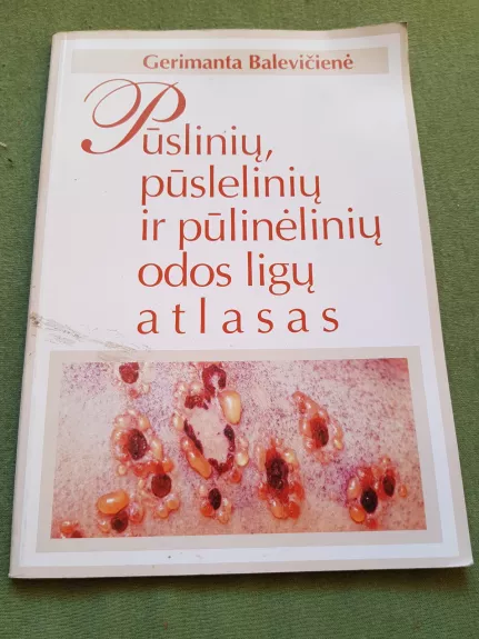Pūslinių, pūslelinių ir pūlinėlinių odos ligų atlasas - Gerimanta Balevičienė, knyga