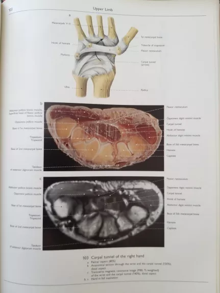 Wolf-Heidegger's Atlas of Human Anatomy, Volume 2: Head and Neck, Thorax, Abdomen, Pelvis, CNS, Eye, Ear - Petra Kopf-Maier, knyga 1