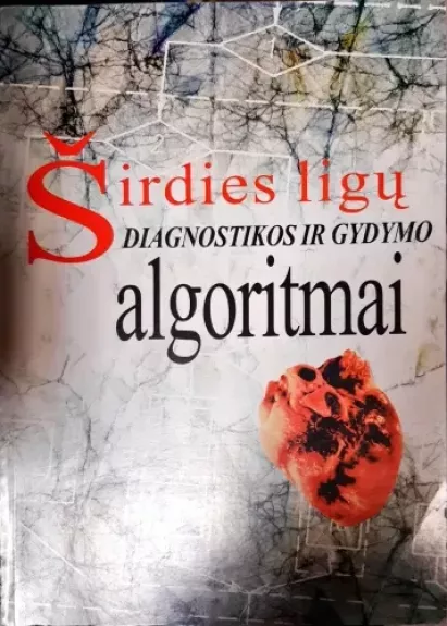 Širdies ligų diagnostikos ir gydymo algoritmai