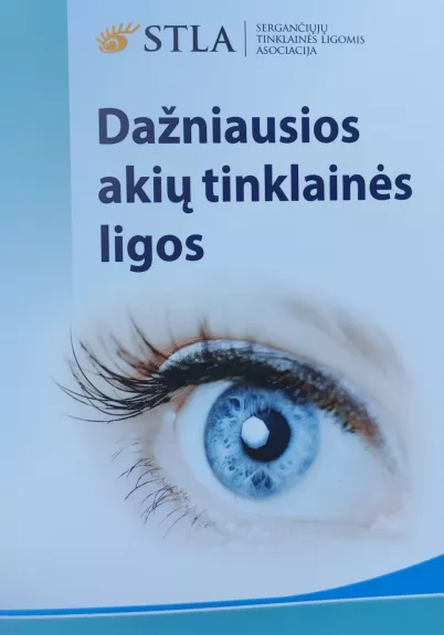 Dažniausios akių tinklainės ligos