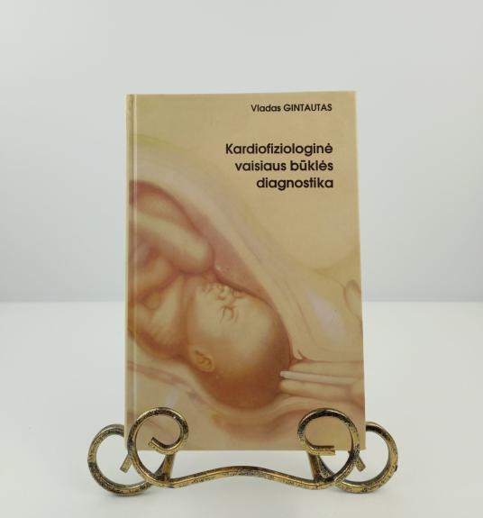 Kardiofiziologinė vaisiaus būklės diagnostika