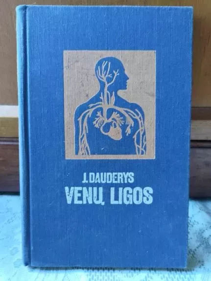 Venų ligos