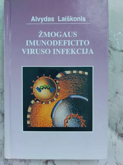 Žmogaus imunodeficito viruso infekcija