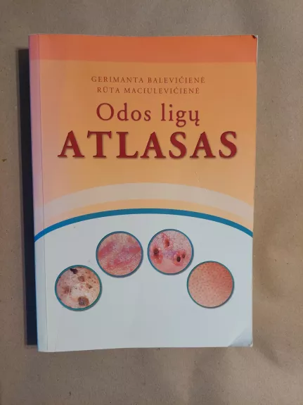 Odos ligų atlasas