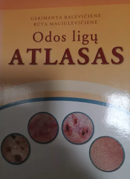 Odos ligų atlasas