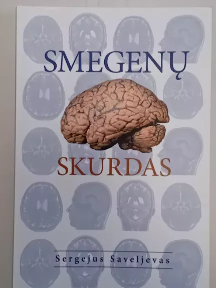Smegenų skurdas - Sergejus Saveljevas, knyga