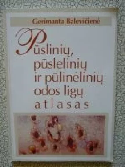 Pūslinių, pūslelinių ir pūlinėlinių odos ligų atlasas - Gerimanta Balevičienė, knyga