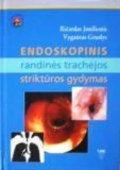 Endoskopinis randinės trachėjos striktūros gydymas. Mokomoji priemonė