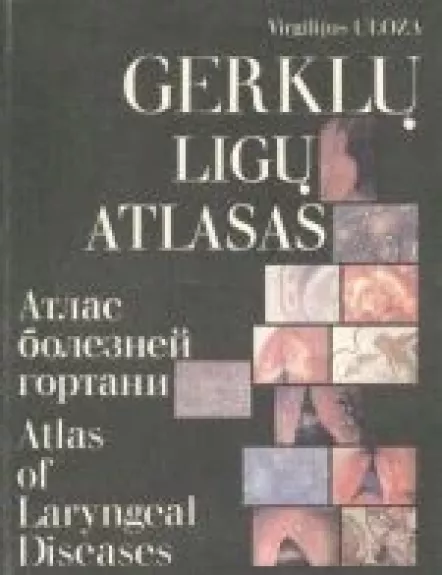 Gerklų ligų atlasas - Virgilijus Uloza, knyga