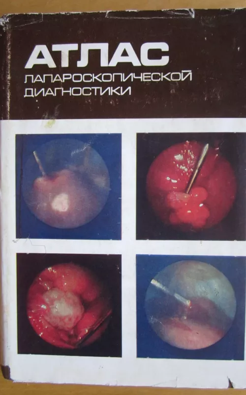 Atlas laparaskopiceskoj diagnostiki - E. G. Koval, knyga
