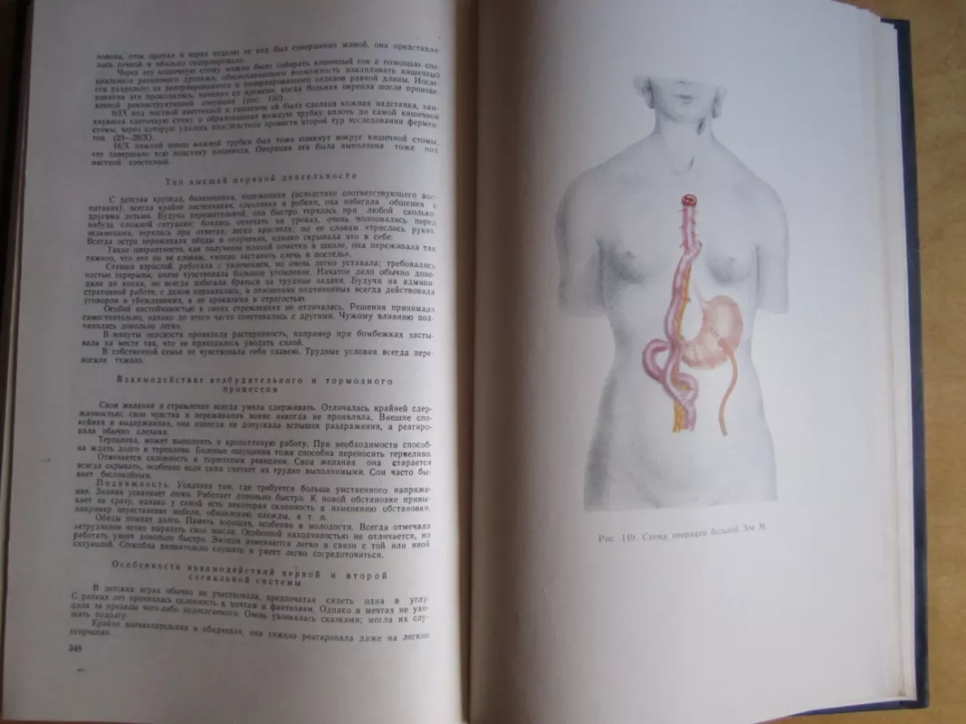 Chirurgija jazvenoj bolezni želudka i neurohumoralnaja reguliacija želudočnoj sekreciji u želoveka - S. S. Judin, knyga 6