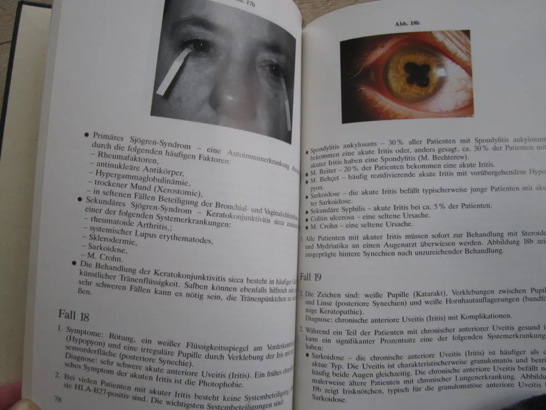 Ophthalmologie Fallbeschreibungen - Jack J. Kanski, knyga 4