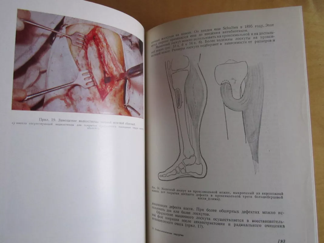 Gnoino septičeskaja chirurgija - Stojan Popkirov, knyga 5