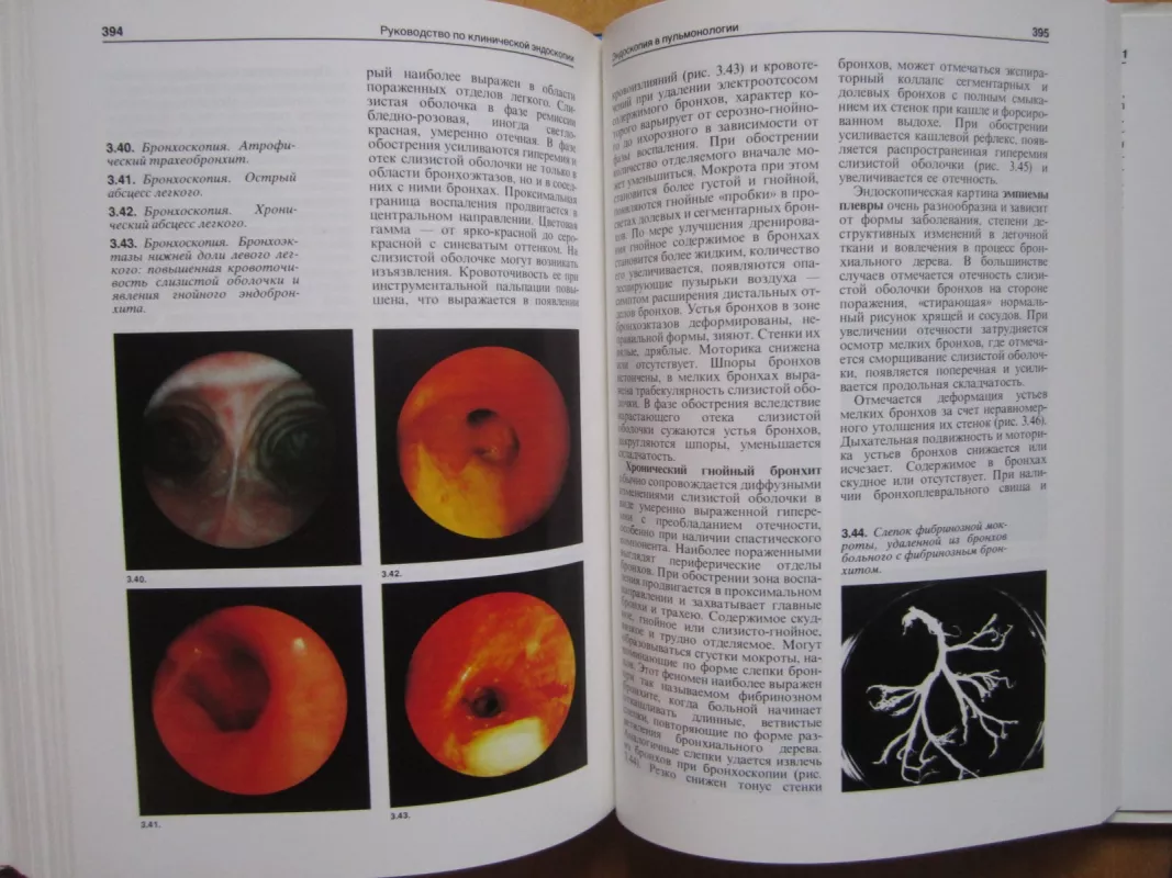 L. Rukovodstvo po kliničeskoj endoskopiji - V. S. Saveljeva, knyga 5