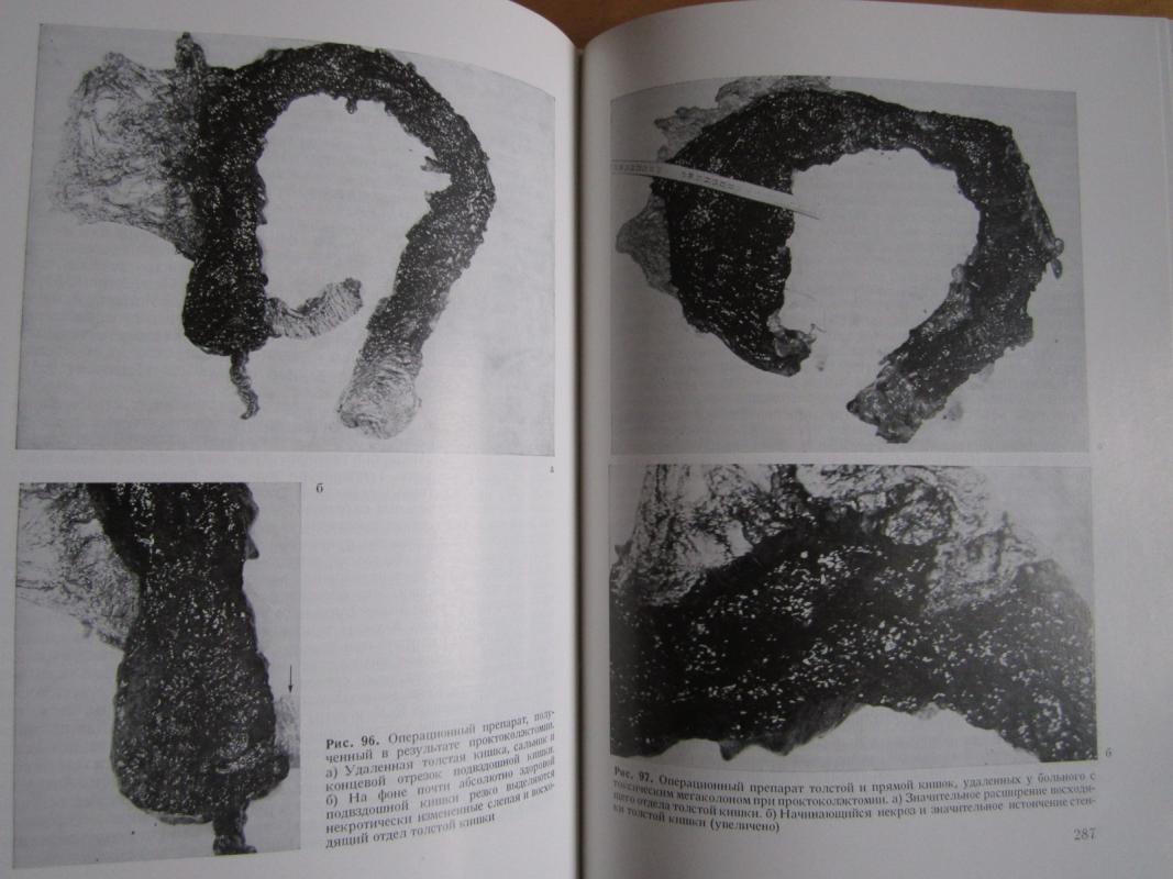 Chirurgija kišečnika - Š. Drobni, knyga 5