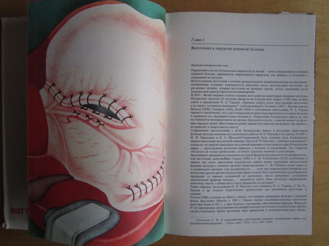 Vagotomija pri osložnionych duodenalnych jazvach - J. M. Pancyrev, knyga 5