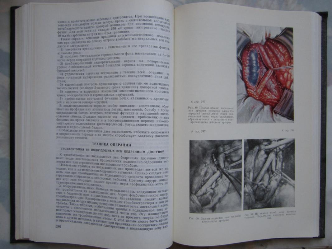 Bolezni magistralnych ven - Autorių Kolektyvas, knyga 5