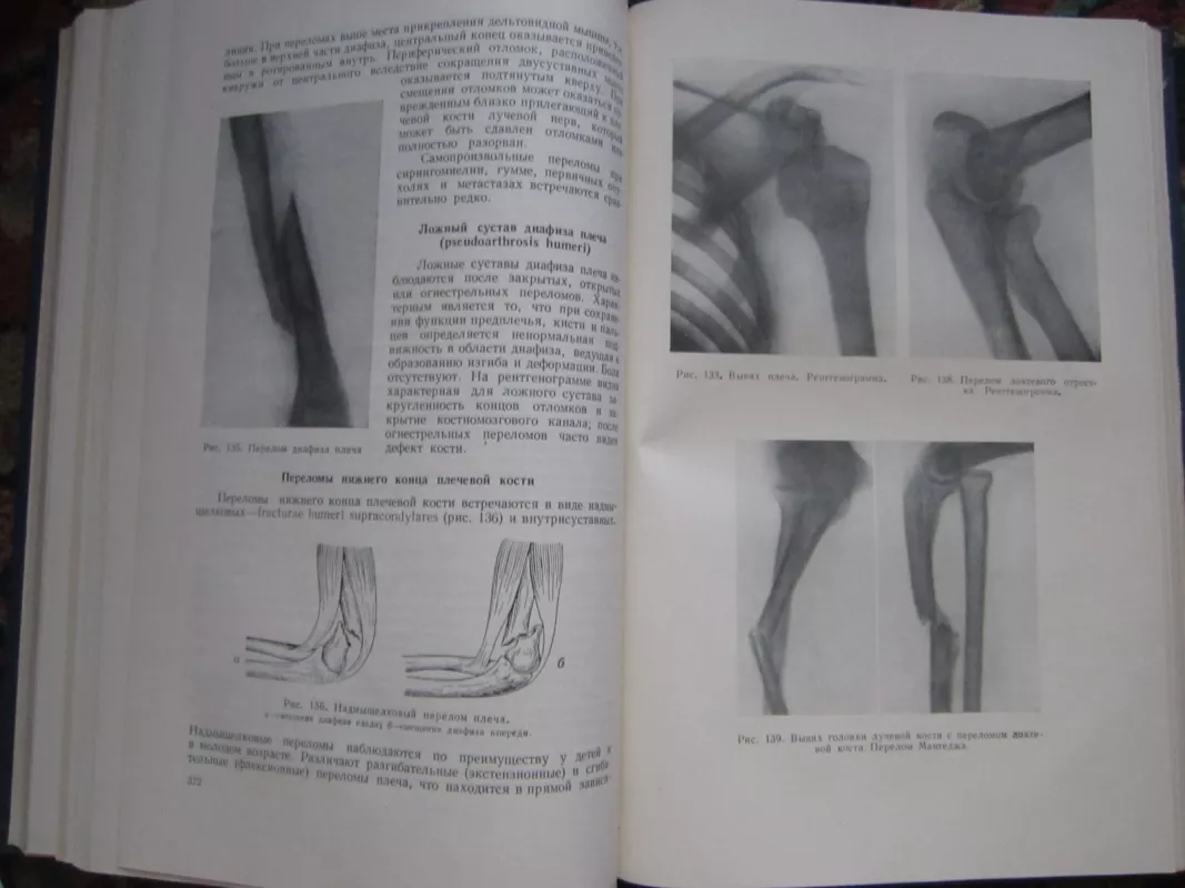 Diagnostika chirurgičeskich zabolevanij - Autorių Kolektyvas, knyga 5