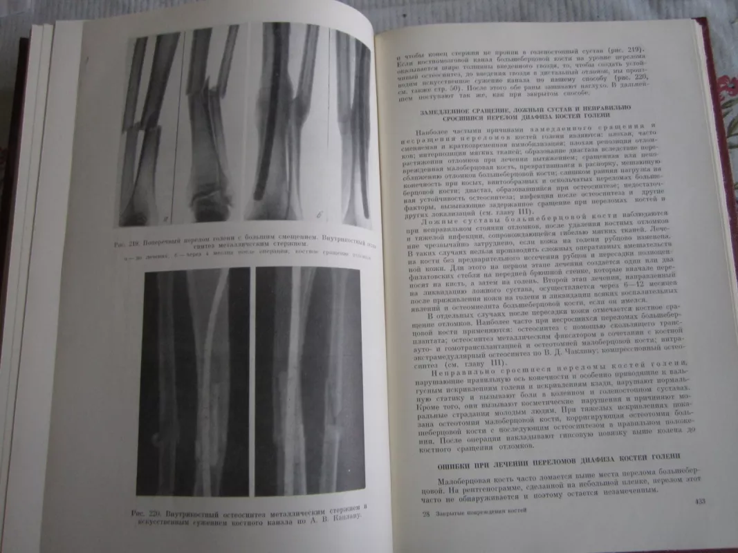 Zakrytyje povreždenija kostei I sustavov - V. A. Kaplan, knyga 5