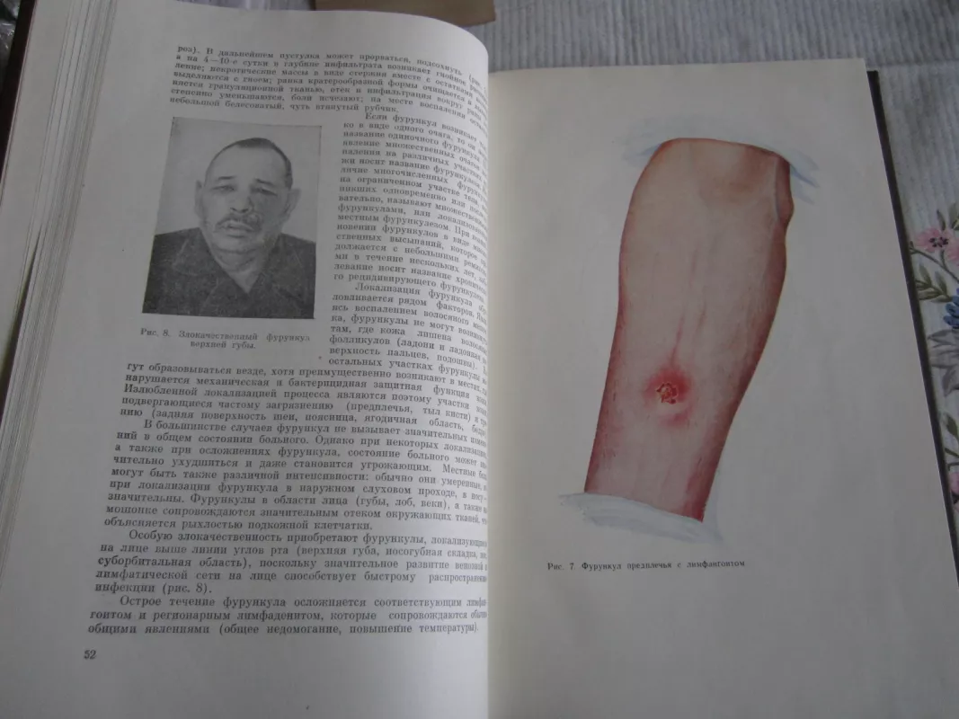 Gnoinaja chirurgija - V. I. Stručkov, knyga 4