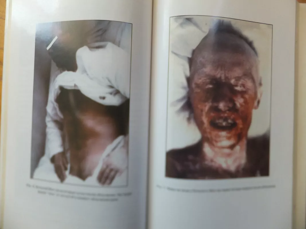 До и после Чернобыля (взгяд врача) - Андрей Ворбьев, knyga 3