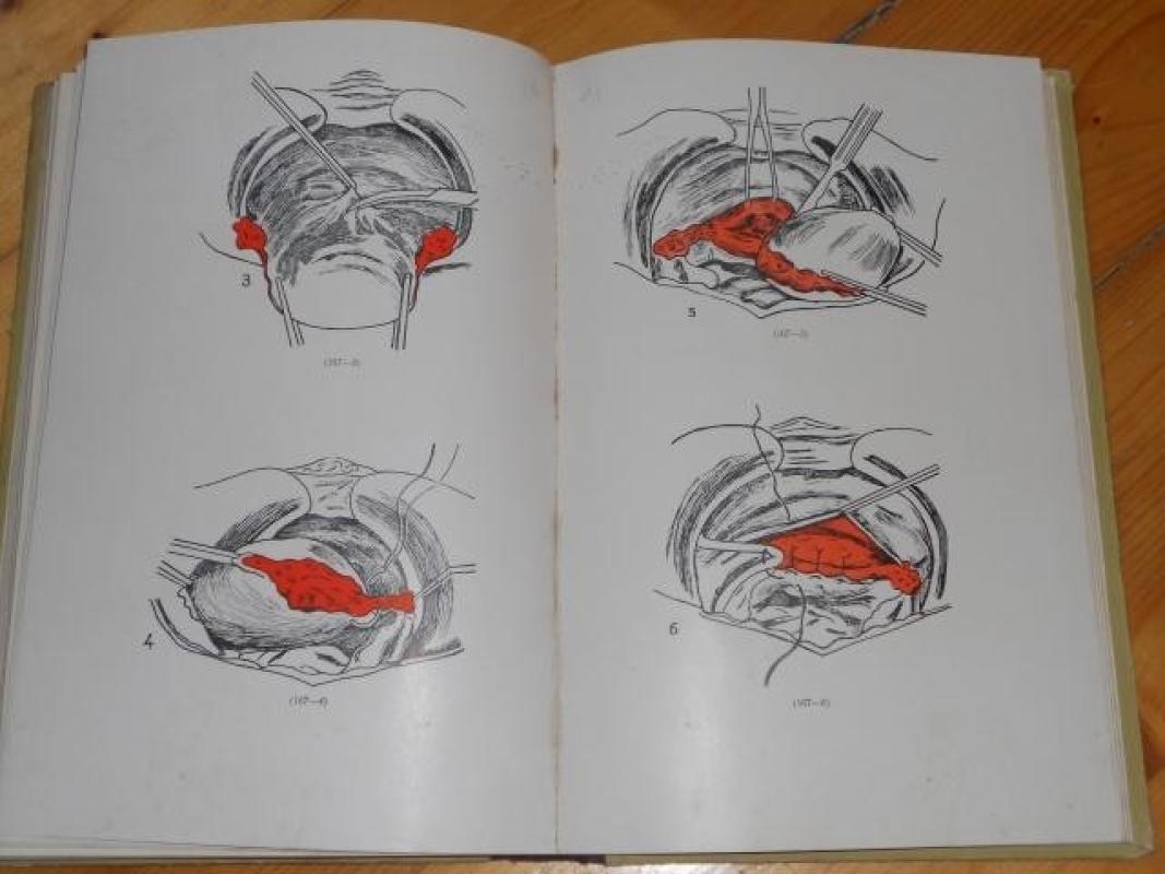 Praktinė ginekologija - V. Baronas, knyga 2