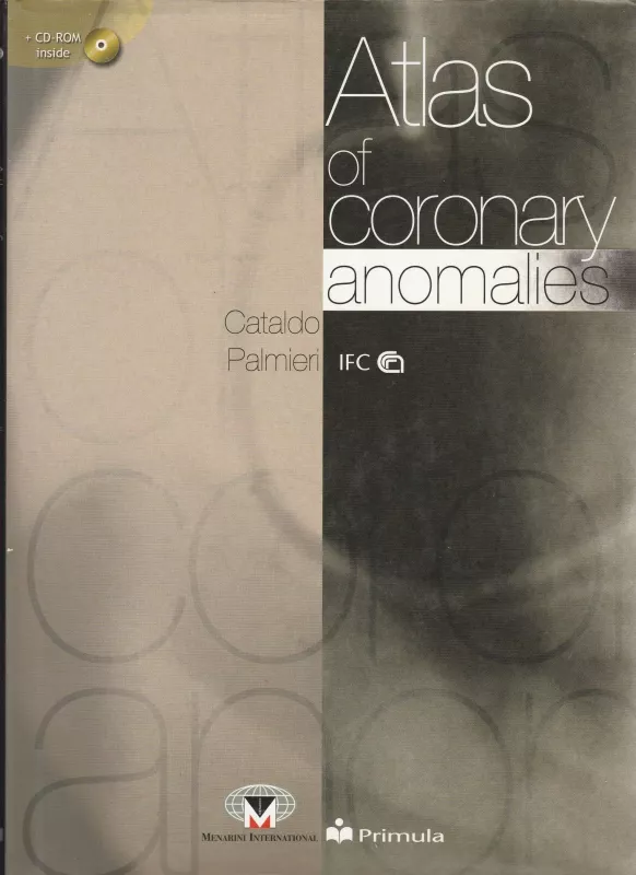 Atlas of coronary anomalies. Con CD-ROM - Cataldo Palmieri, knyga