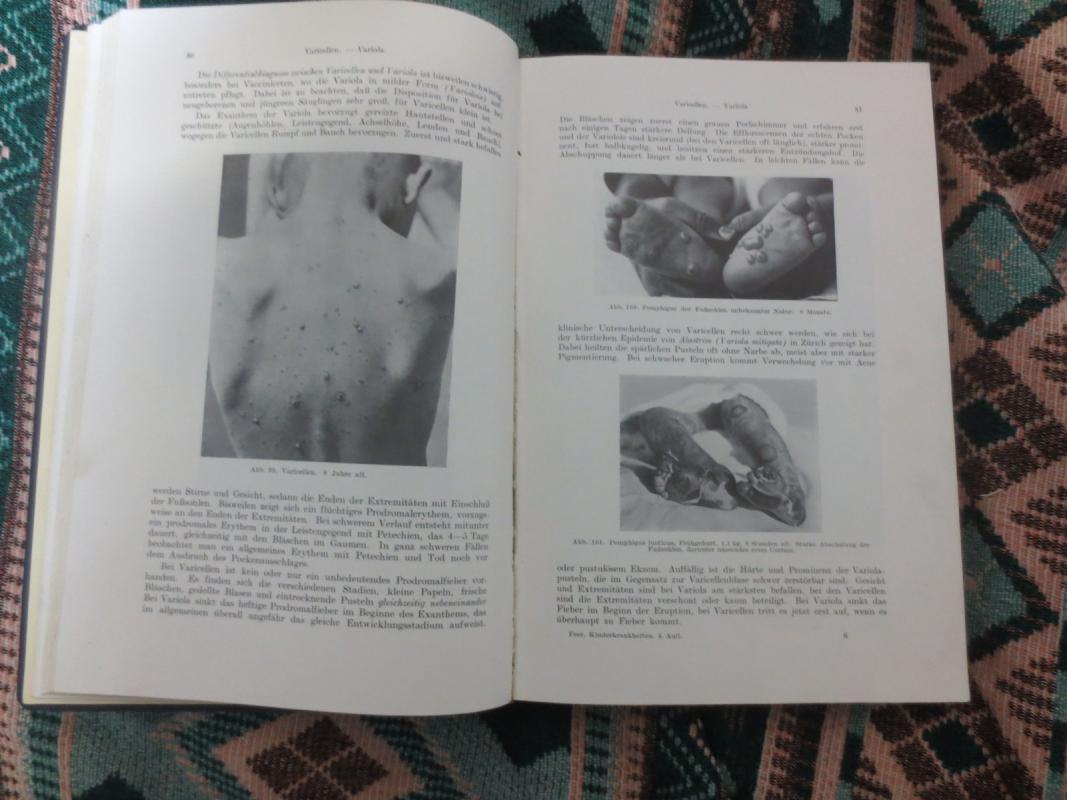 Diagnostik der Kindrekrankheiten - E. Feer, knyga 2