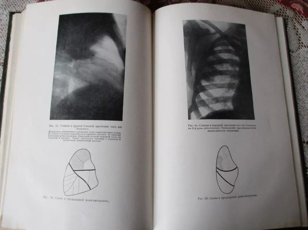 opyt sovietskoj mediciny v velikoj otečestvennoj 30-tas tomas - Autorių Kolektyvas, knyga