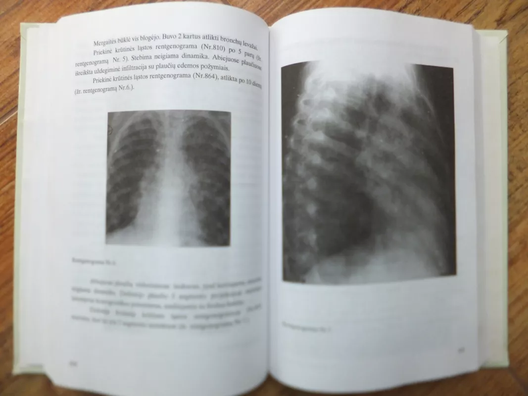 Cistinė fibrozė - Autorių Kolektyvas, knyga 5
