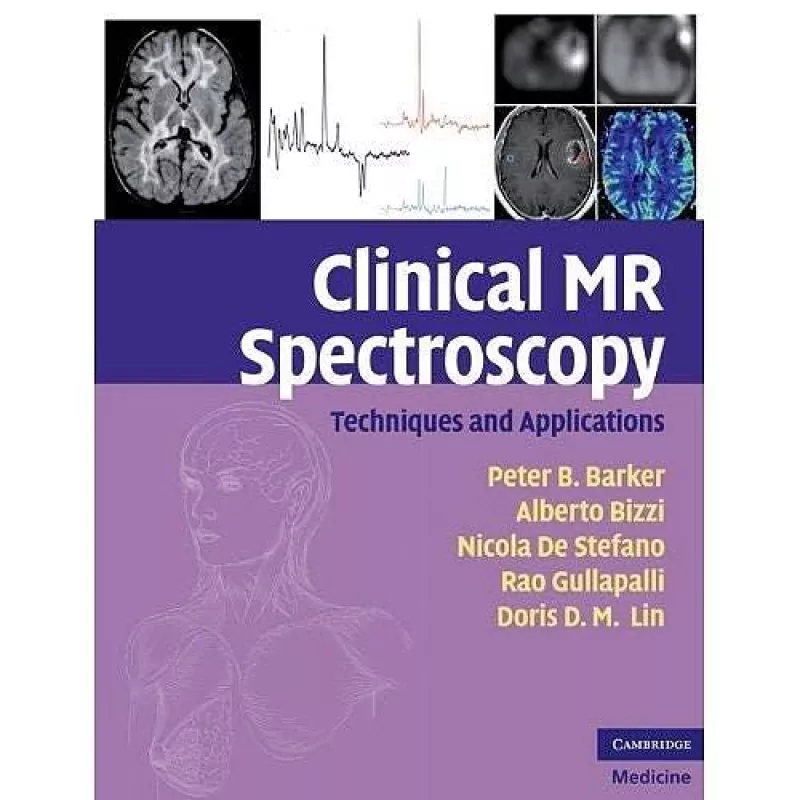 Clinical MR Spectroscopy: Techniques and Applications - Peter B. Barker, knyga