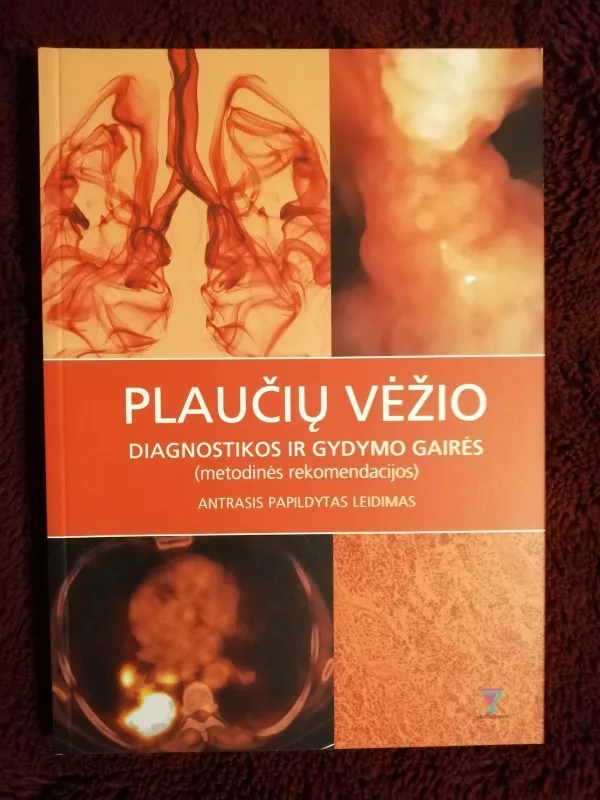 Plaučių vėžio diagnostikos ir gydymo gairės (metodinės rekomendacijos) Antrasis papildytas leidimas - Autorių Kolektyvas, knyga 4