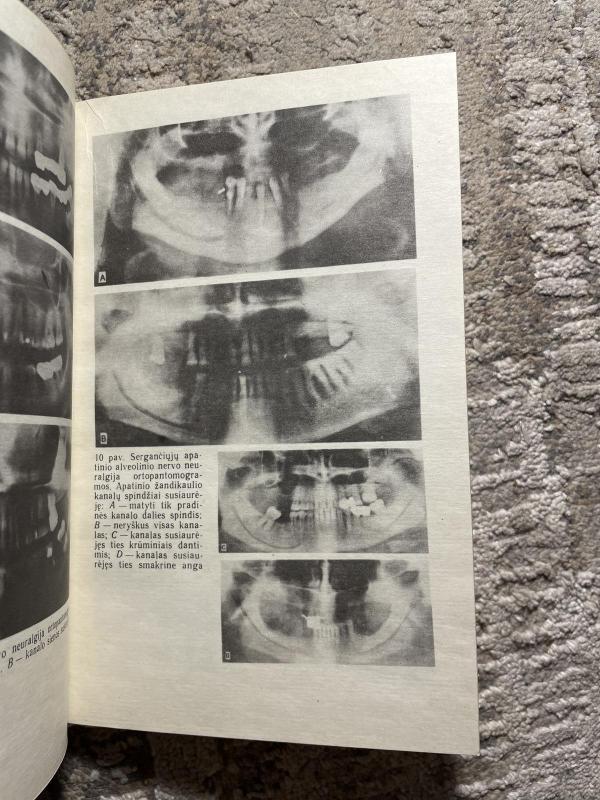 Trišakio nervo neuralgija - Autorių Kolektyvas, knyga 3