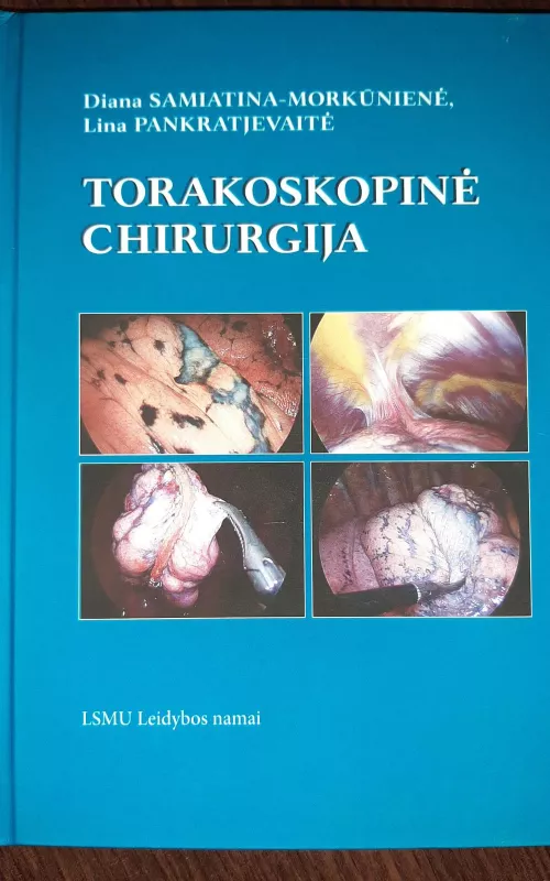 TORAKOSKOPINĖ CHIRURGIJA - Autorių Kolektyvas, knyga 2