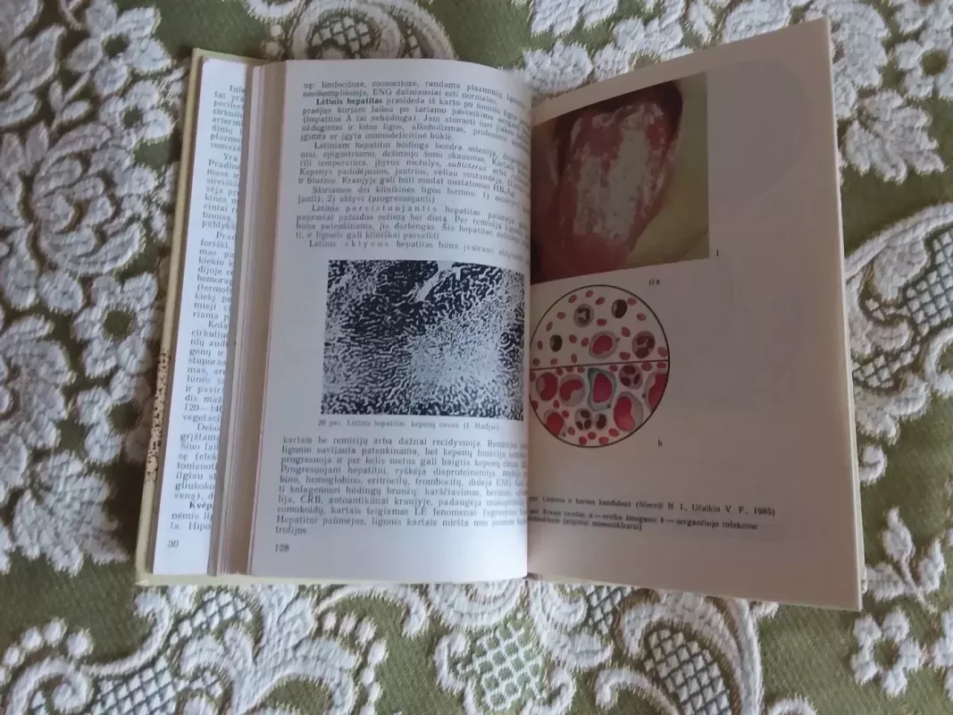 Infekcinės ligos - P. Čibaras, J.  Ūsaitis, knyga 4