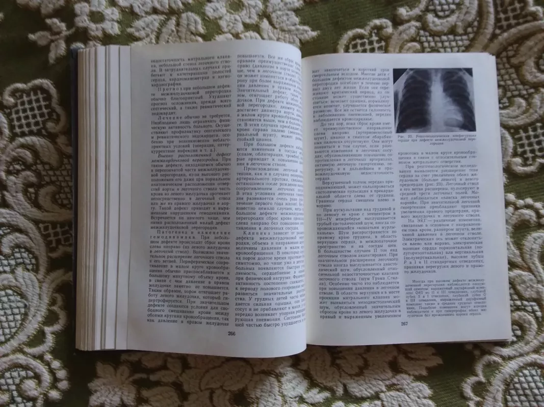 Внутренние болезни - Autorių Kolektyvas, knyga 5