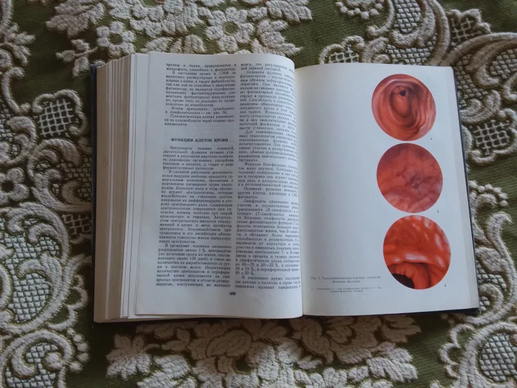 Внутренние болезни - Autorių Kolektyvas, knyga 4