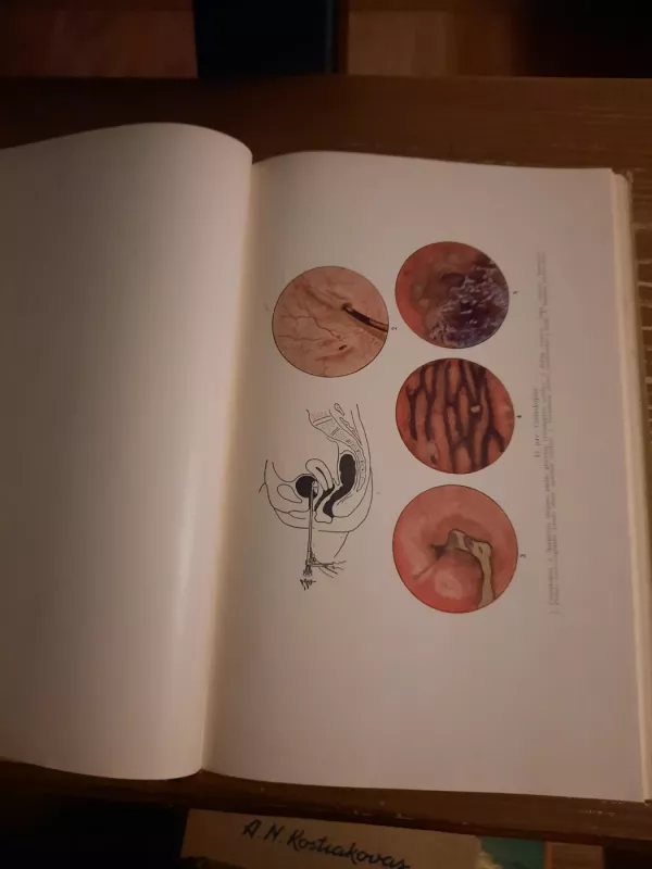 Praktinė ginekologija - V. Baronas, knyga 4