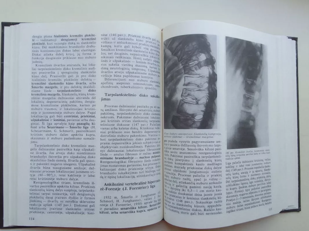 Atramos judamojo aparato ligų rentgenodiagnostika - Kazys Ambrozaitis, knyga 6