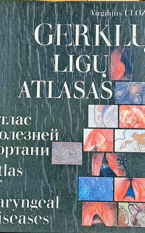 Gerklų ligų atlasas - Virgilijus Uloza, knyga 2